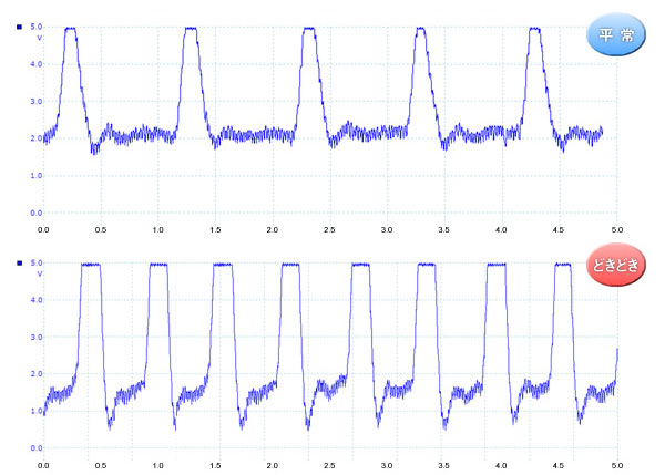 図1：平常時（上）とどきどき時（下）の心拍データ