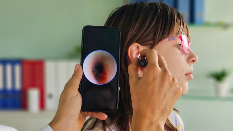 ENT examines ear of young girl using otoscope and displaying results on smartphone
